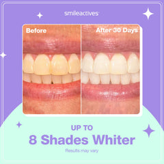 Close-up of precision brush tip applying whitening gel