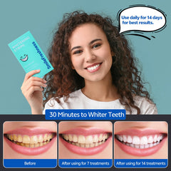 SmileFreshness box and 28-strip whitening kit