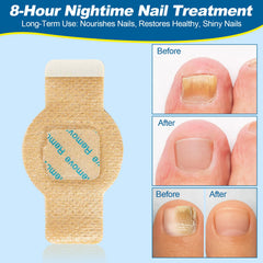Snifflink night-use patch applied on nail for overnight renewal routine.