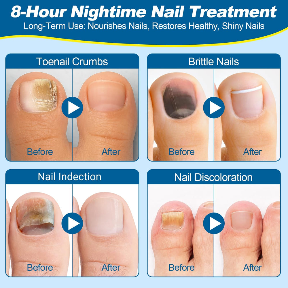 Snifflink tear-and-stick toe patches in use for easy application.