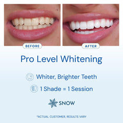 Close-up of wand applying whitening serum