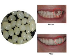 Boiling water molding process for temporary teeth beads