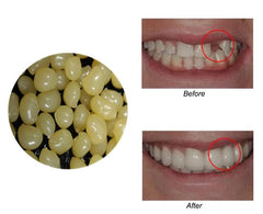 Packaged Sowsmile 4-color beads kit for teeth repair
