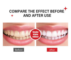 Fresh breath and stain removal with Sp-6 toothpaste