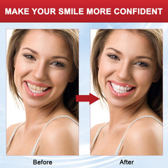 SP8 probiotic toothpaste packaging with toothbrushes set