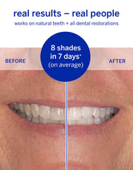 Whitening up to 8 shades in 7 days indicator