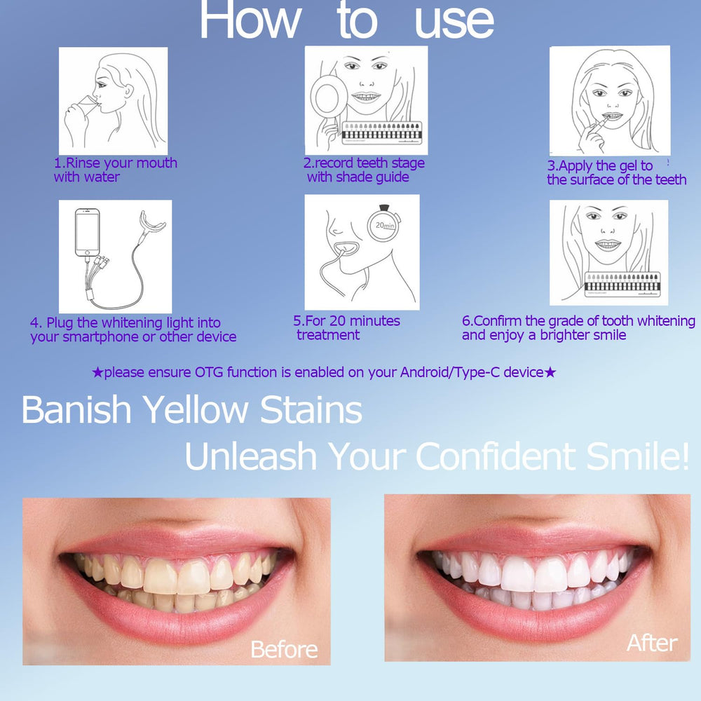 Silicone tray molded for all mouth shapes