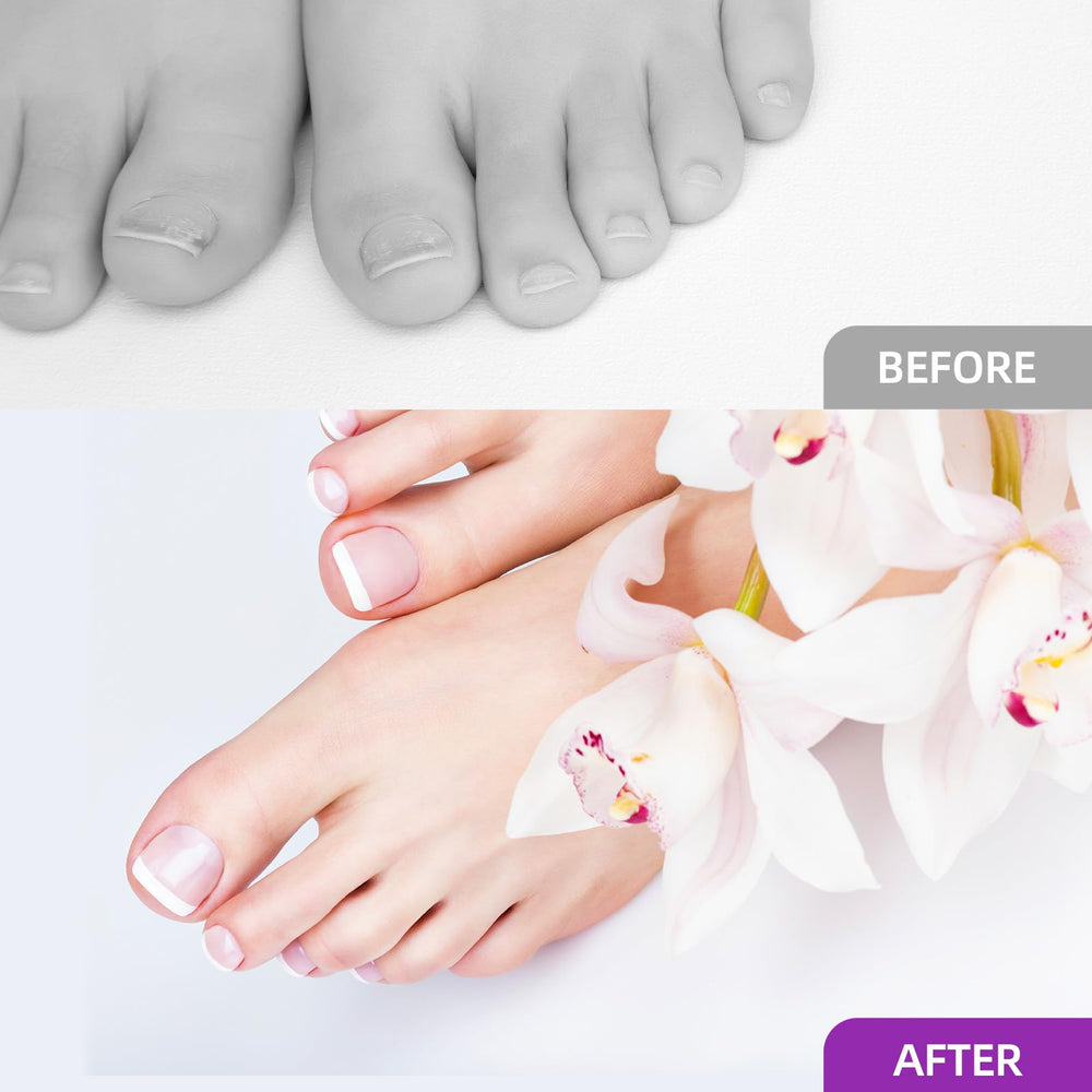 Tbestmax clips secure forms during curing for clean results.