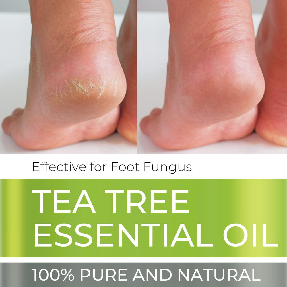 Side angle of 4 oz tea tree essential oil bottle with dropper