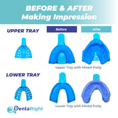 Protects teeth from daily wear