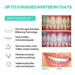 Whitening light connected to iPhone via adapter
