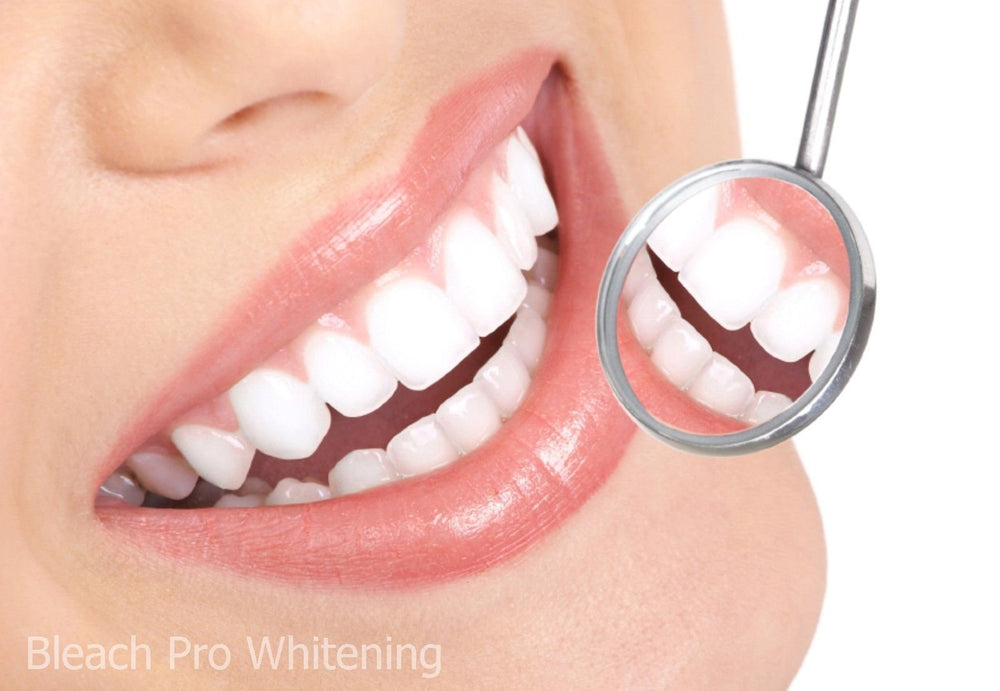 Whitening gel kit components on white background