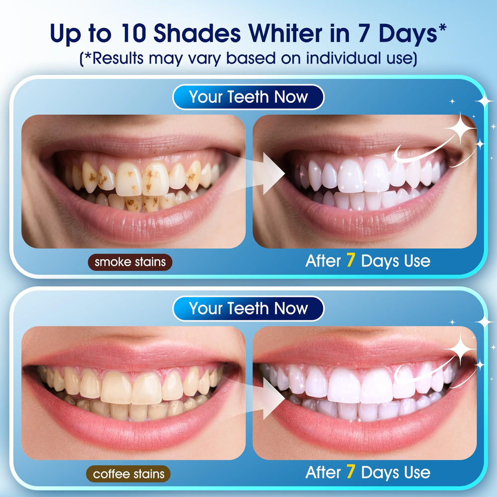 LED whitening light device included in the kit