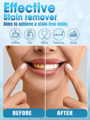 Dual LED light array providing full-mouth whitening coverage