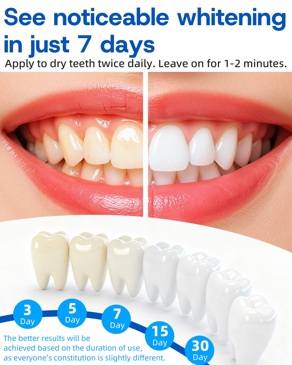 Precision tip of whitening gel pen