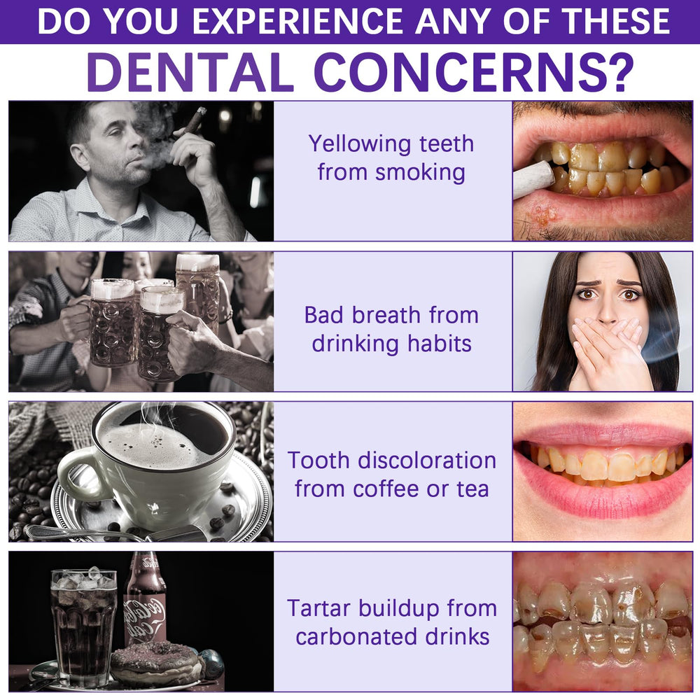 Close-up of coffee-stained teeth before whitening