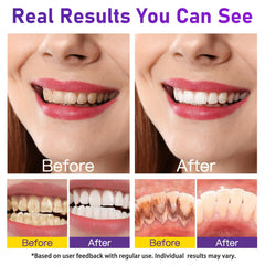 Breath freshness and stain removal concept with coffee cup