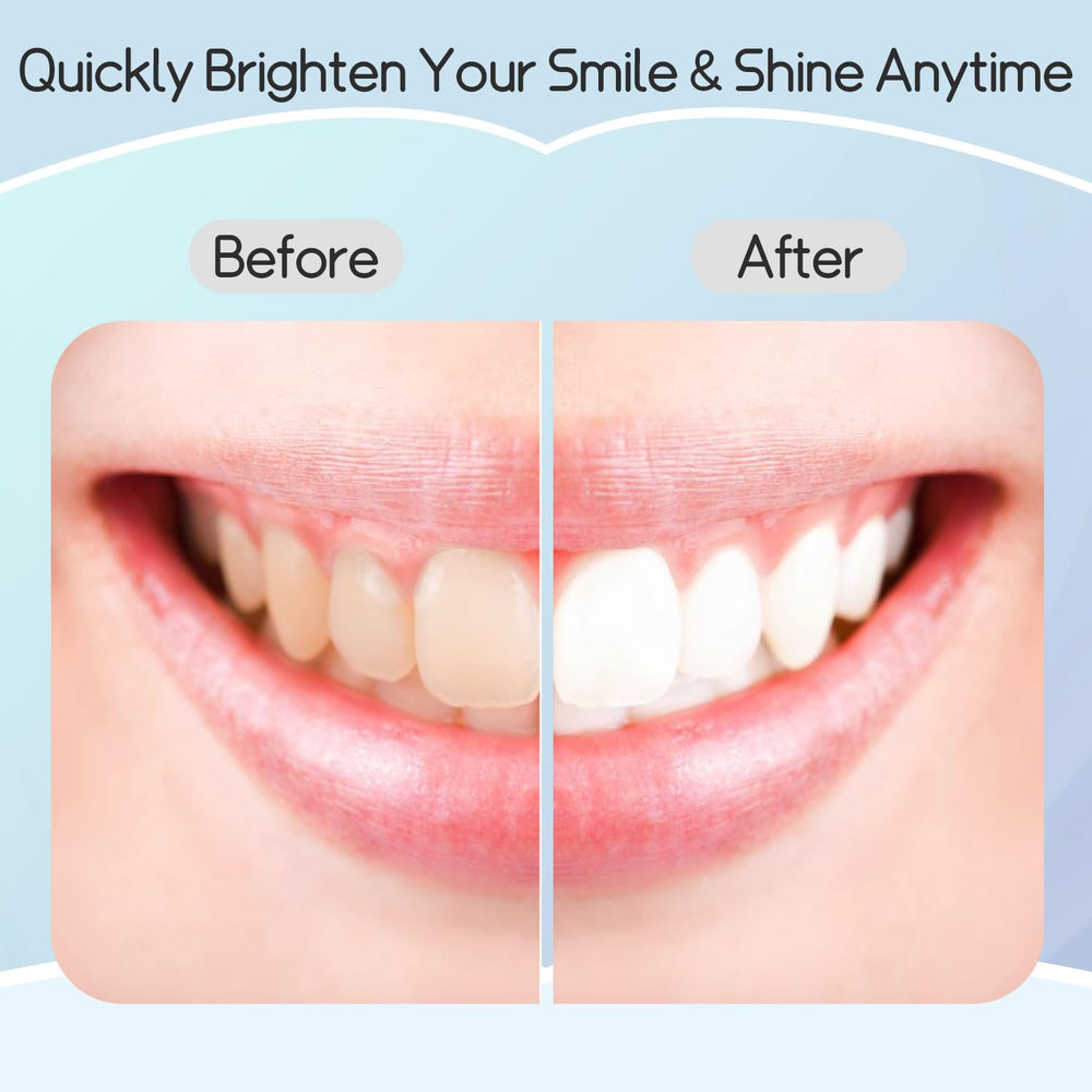 Before and after whitening results