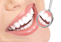 Ten 3ml whitening gel syringes included in kit