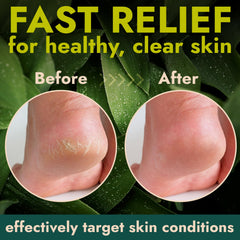 Terramed Just Think Comfort no-mess-stick in hand for precise, mess-free application.