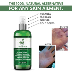 Thyme Out anti-itch spray mist provides quick, cooling relief during daily activities.