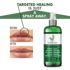 Thyme Out packaging and 4oz bottle emphasize a compact, travel-friendly size.