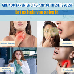 Mouthwash demonstrating tonsil stone defense action