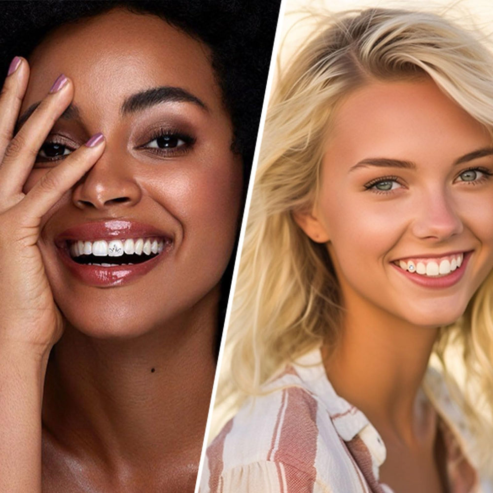 Before and after use of tooth gems on teeth