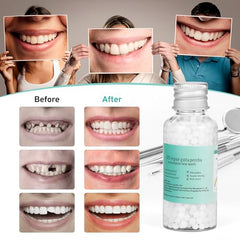 Hands shaping moldable beads to fit a tooth