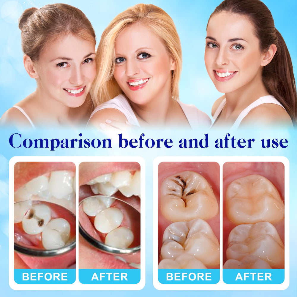 Liquid component (16ml) of the Tooth Repair Kit