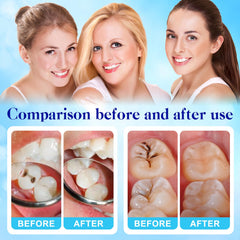 Liquid component (16ml) of the Tooth Repair Kit