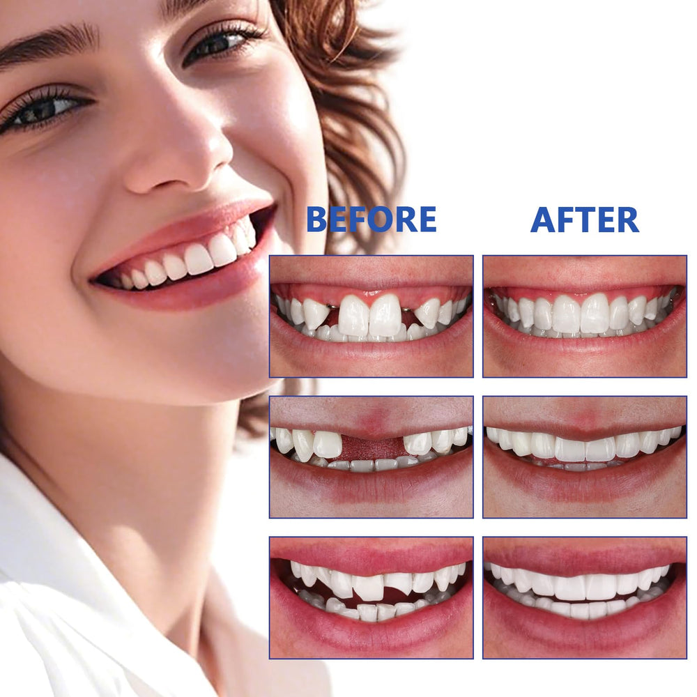 Temporary tooth filling kit ready for use