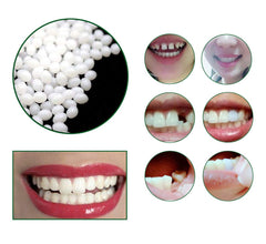 Person smiling with a temporary tooth restoration