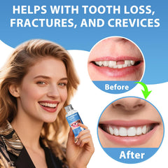 Soft, comfortable beads for temporary tooth restoration