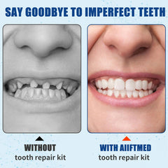 Close-up of dental filling application from the kit