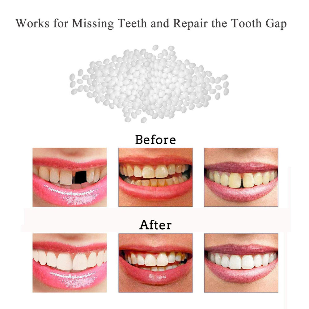 Tooth Repair Kit with beads and instruction manual