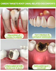 Tooth with reinforced dentin and surrounding bone concept