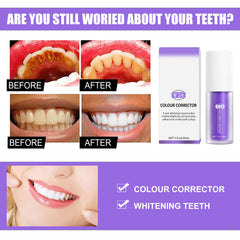 Toothpaste whitening stain removal close-up