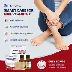 Treatonic discolored nail improvement visual during treatment.