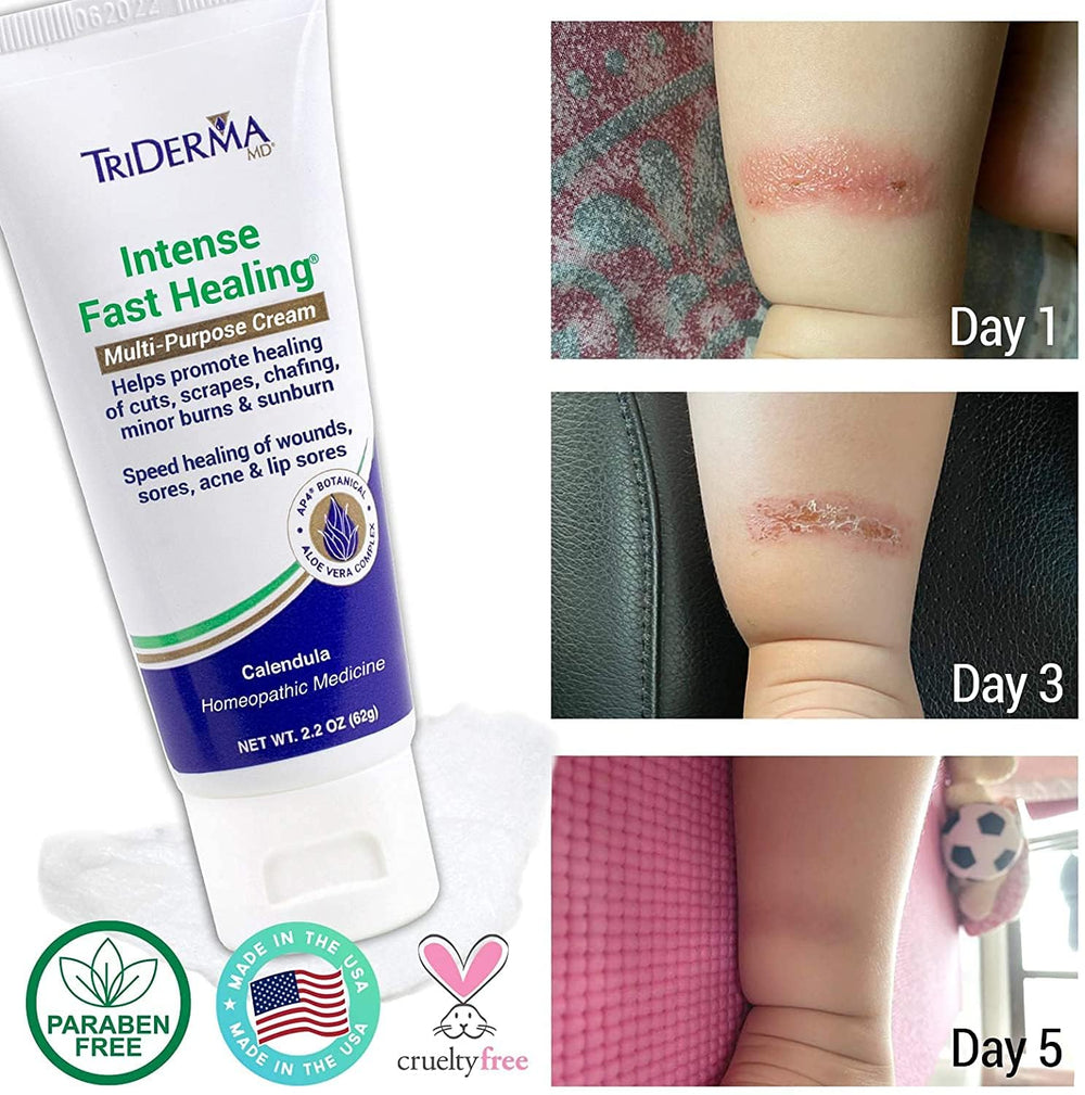 TriDerma MD Intense Fast Healing Cream on dry skin showing soothing relief potential