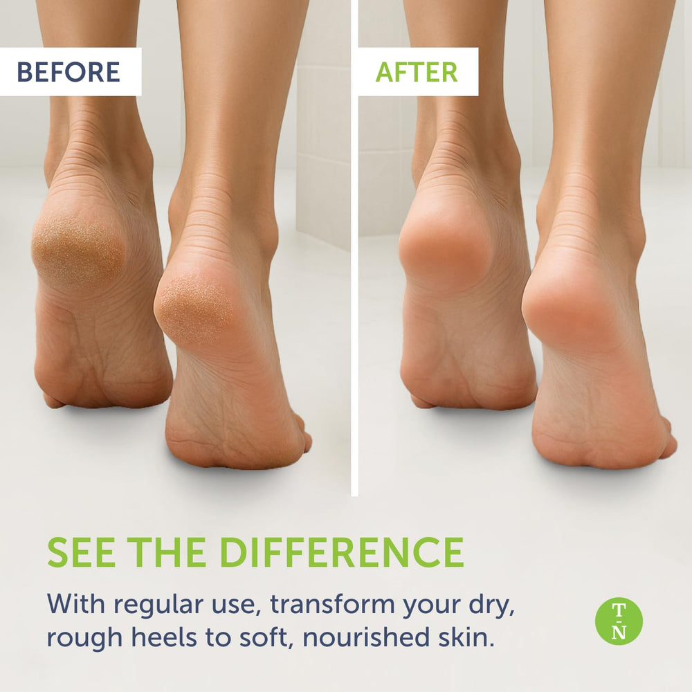 Truremedy Naturals Remedy Balm nourishing ingredients closeup for skin nourishment