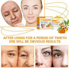 Turmeric Face Cream with soothing botanicals supports gentle daily care