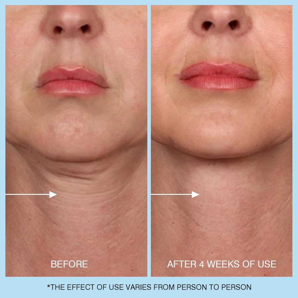 UJhay Retinol Neck Cream packaging and product display.