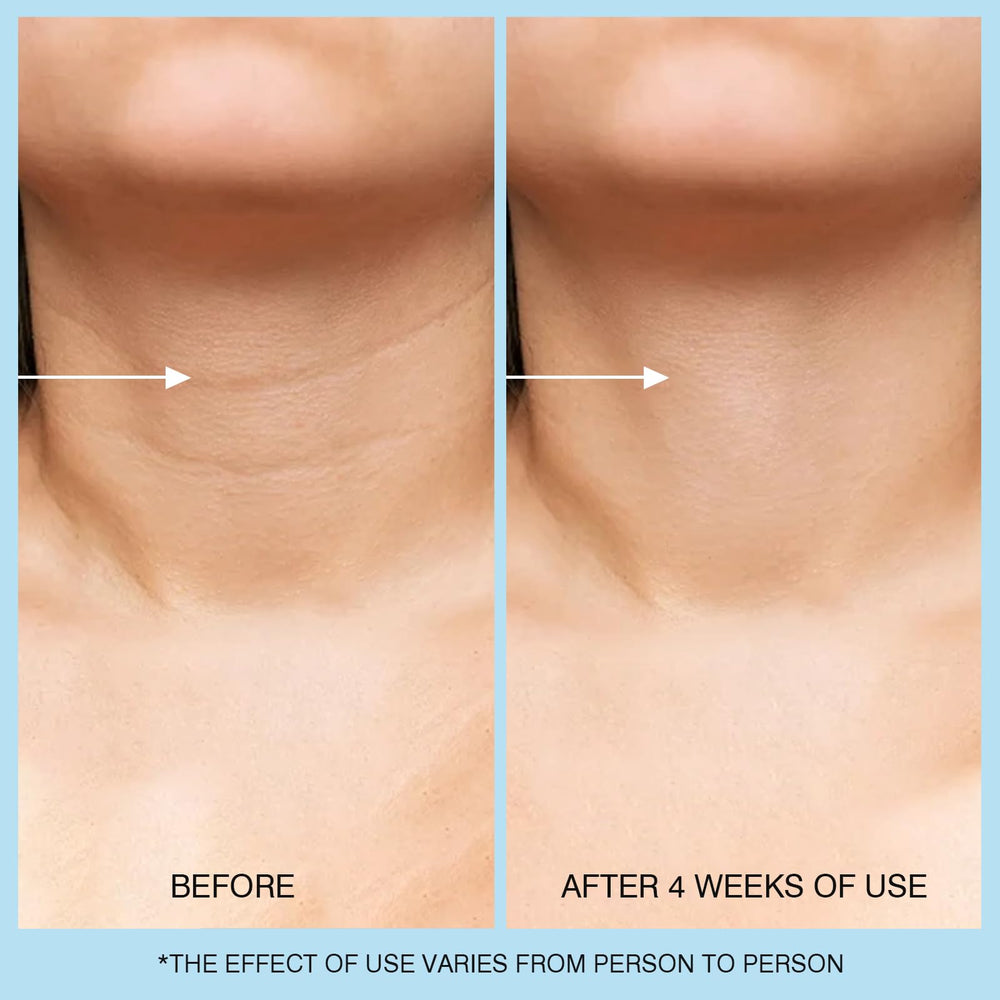UJhay Three in One Neck Face Chest application on skin surface.