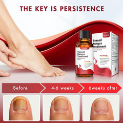 UKVOA nail repair supports smoother, clearer nail appearance over time.