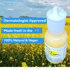 Urban ReLeaf Lysine & Lemon Balm Gel application demonstrates soothing, non-sticky touch for blisters.