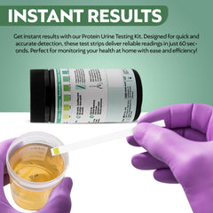 Urinalysis color chart on the strip wrapper