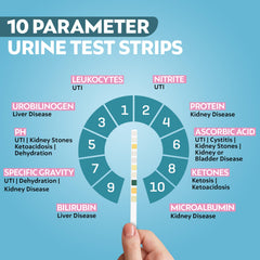 Urine test strips showing 10-in-1 parameters for urinalysis (image 3)