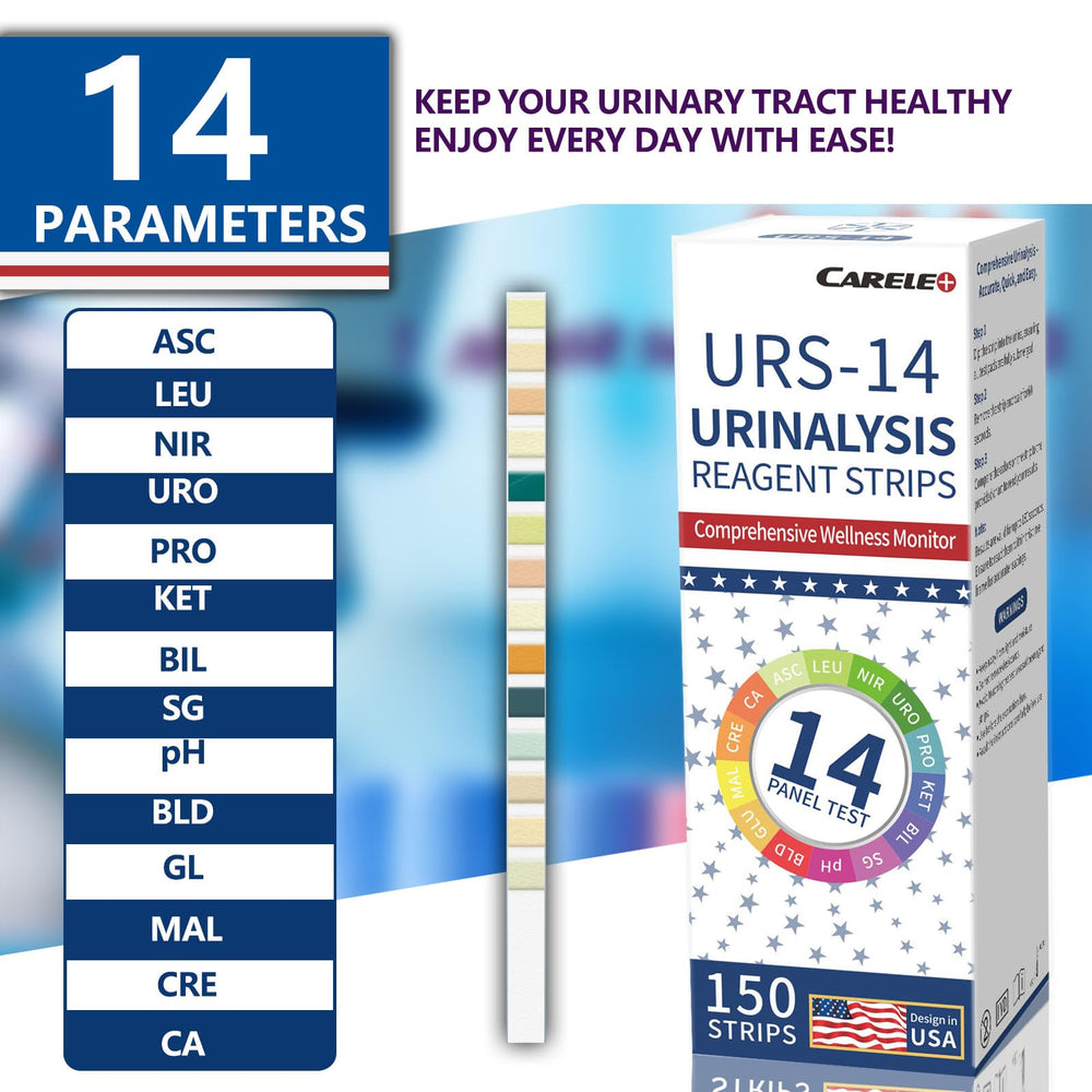 Test strip dipped in urine with color comparison chart