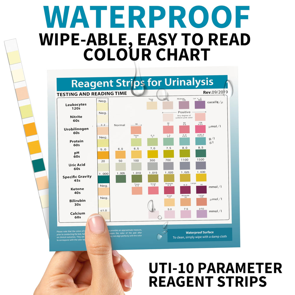Close-up view of URS urine test strip indicators